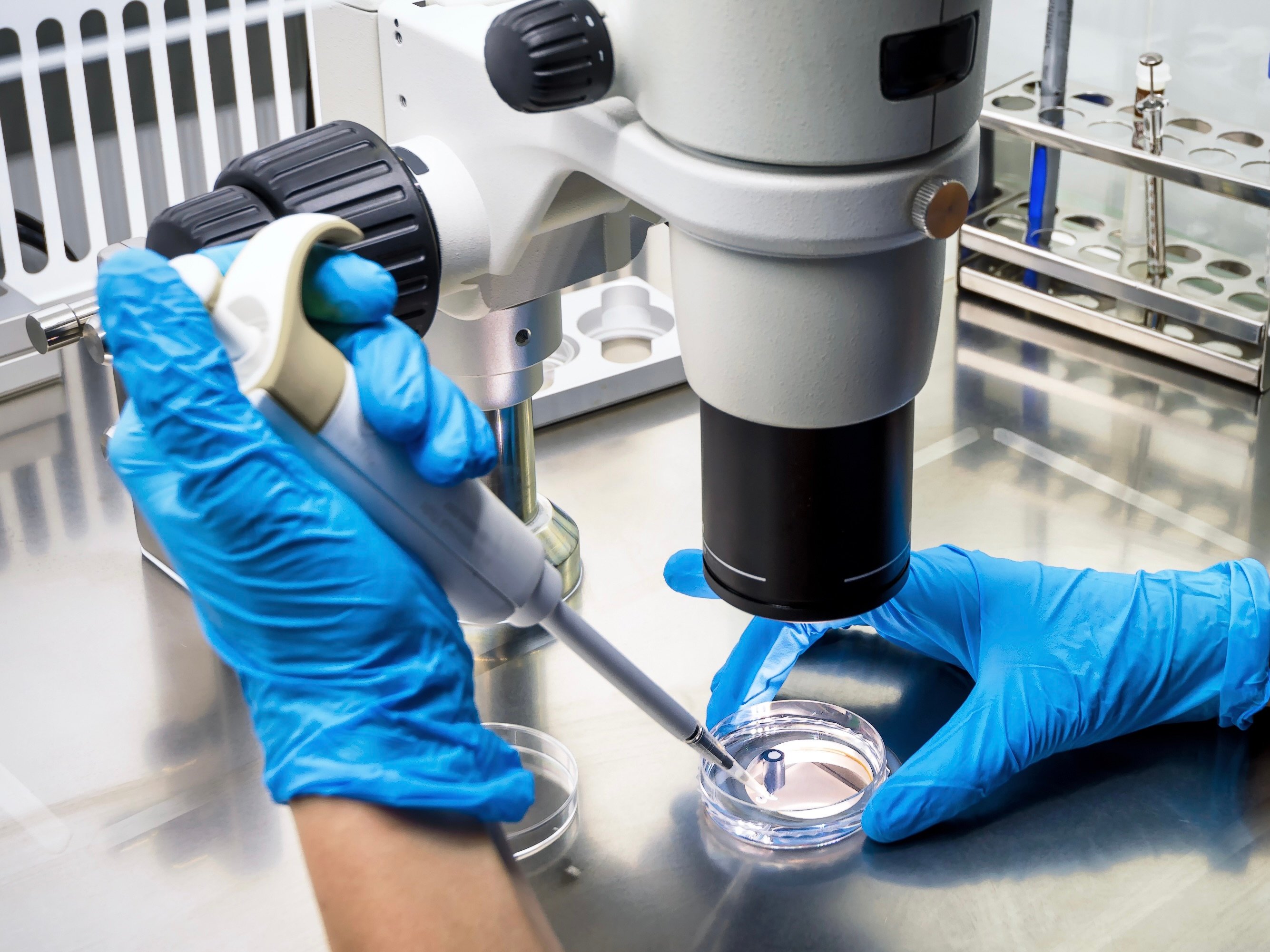 A close-up photo of a medical researcher holding a pipette over a petri dish underneath a microscope.